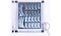Diamond Delux - Model iView Series - Silmmest X-Ray Film Viewer