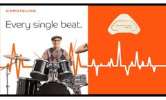 Walk Free: wearable 3 channel cable-free Holter ECG  - Video