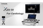 Case Sharing in Cardiology - XBit 90 - Video