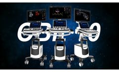 CHISON CBit 10- Premium at Hand - Video