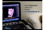 CHISON SonoBook9-Diagnostic Ultrasound Images - Video
