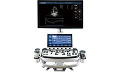 CHISON - Model XBit 90 - Premium Ultrasound System