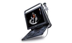 CHISON - Model EBit 60 - Portable Ultrasound System