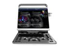 CHISON - Model EBit 50 - Portable Ultrasound Machine