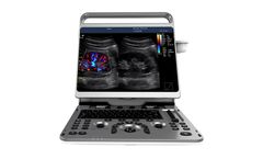 CHISON - Model EBit 50 - Portable Ultrasound Machine