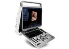 CHISON - Model EBit 30 - Portable Ultrasound Machine