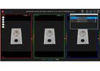 Fusion - Version MR - Software for Interpreting MRIs of the Prostate