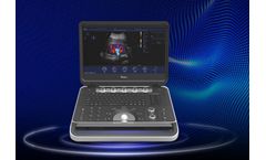 Focus & Fusion - Model Finus Series - Ultrasound Imaging System