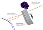 Inari Medical - Model FlowStasis - Suture Retention Device