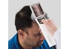 Model Hairmetrix - Fully Automated Real-Time Analysis