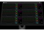 Digicare - Model CentralVue CV10 - All-In-One Telemetry Monitoring System