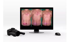 QuantifiCare - Model 2D DermaViz Series - Fully Handheld Photography Device