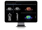 INFINITT PACS - Radiology PACS