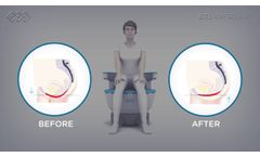 BTL EMSELLA - Mechanism of Action - Video