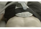 EMSCULPT - Muscle and Sculpt Build Procedure