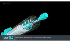 Antibiotic Bone cement - Powder/paste All-In-One Mixing System DOUJET G type - Video