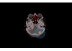 Model CAM-H2 - Consists of an Her2-Targeting Single-Domain Antibody