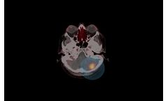 Model CAM-H2 - Consists of an Her2-Targeting Single-Domain Antibody