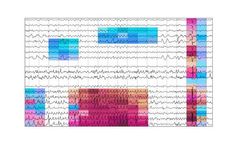 Beacon - EEG Analytics Platform