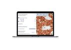 Aiforia - Version PD-L1 - Clinical AI Model for Lung Cancer