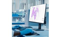 Aiforia - Clinical AI Model for Diagnostic Support Services