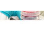 T-Cure - Model 820TCR - Kita-Kyushu Lung Cancer Antigen-1 (KK-LC-1)