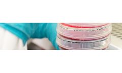 T-Cure - Model 820TCR - Kita-Kyushu Lung Cancer Antigen-1 (KK-LC-1)