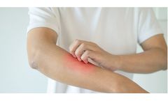 Model LT5001 - Uremic Pruritus