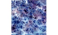 Aindra - Model Astra - Al Platform for Facilitate Computational Pathology