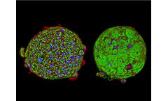 InSphero 3D InSight - Model NASH - Advanced 3D Human Liver Disease