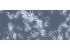 DeltEx DRI CAR-T - Model INB-300 - Gamma-Delta T Cells