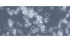 DeltEx DRI CAR-T - Model INB-300 - Gamma-Delta T Cells