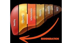 HepaRegeniX - Liver Diseases Face an Enormous Unmet Medical Need