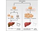 HepaRegeniX - A First-in-class Therapeutic Target