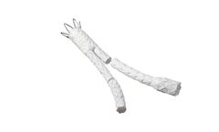 Ankura - AAA Stent Graft