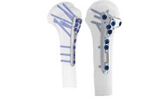 Intrauma - Model PHF & PGR - Plate Proximal Humerus