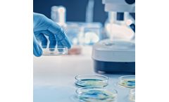 Autoimmune In Vitro Diagnostics and Lab Automation