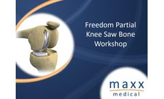 Freedom Renew - Resurfacing Unicondylar Total Knee System - Surgical Technique - Brochure