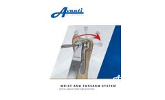 Distal Radius Fracture Fixation (Single Page Version) - Brochure