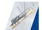 Avanti - Ulnar Shortening System