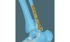 Fibula