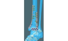 Tibia