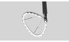 AMEND - Mitral Repair Implant