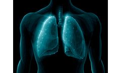 Model ENA-001 - New Chemical Entity (NCE) Drug