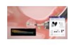 Zephyr Valve Patient Selection - Video