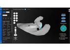 Shoulder - Version PreView - 3D Pre-Operative Planning Software