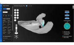 Shoulder - Version PreView - 3D Pre-Operative Planning Software