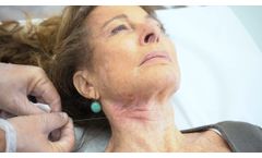 EndoPlexr - Neck Lifting - Video