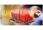 GCell - Autologous Tissue Suspension - Microgreft