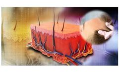 GCell - Autologous Tissue Suspension - Microgreft